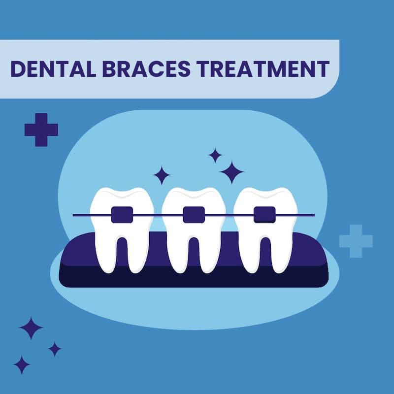dental braces treatment