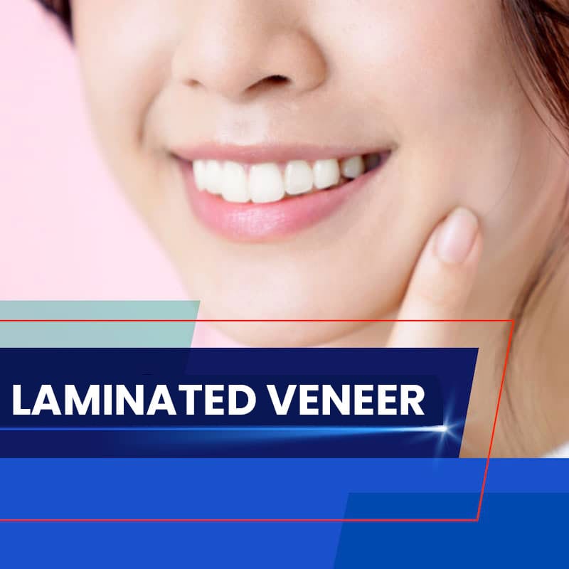 Risks of Laminate Dental Veneer Procedure