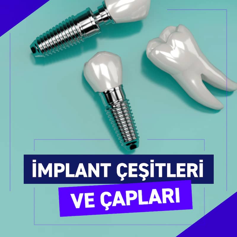 İmplant çapları neye göre belirlenir
