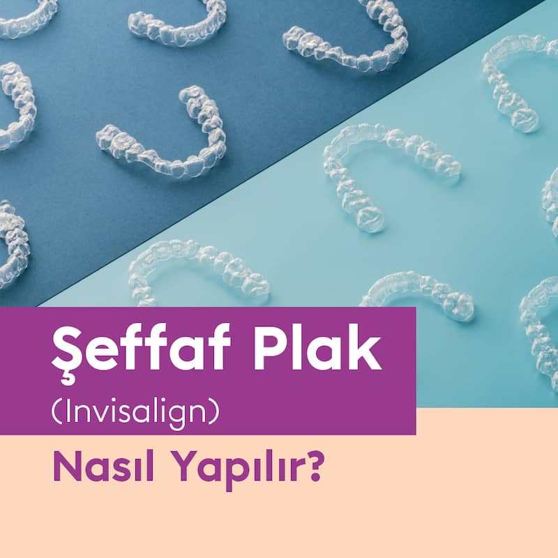 Şeffaf diş plağı uygulaması